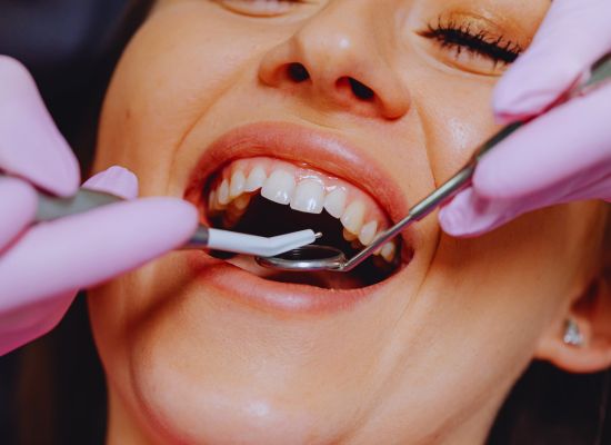 Dentista realizando tratamento estético dentário
