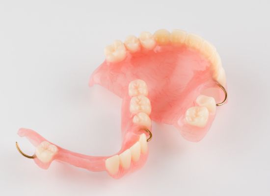 Dentista ajustando prótese dentária