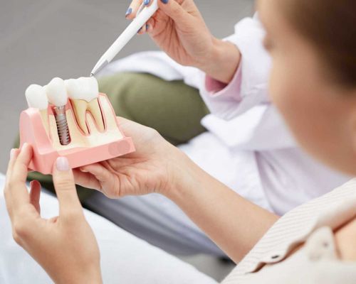 Dentista realizando procedimento de implantodontia