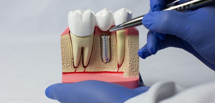 Imagem ilustrativa de tratamento odontológico
